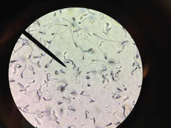 How do you find sperm with a black light?