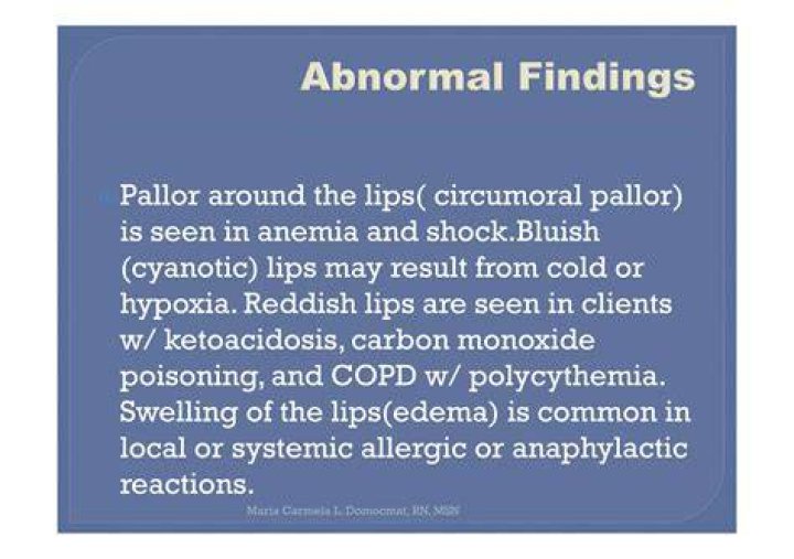 Is circumoral pallor normal?
