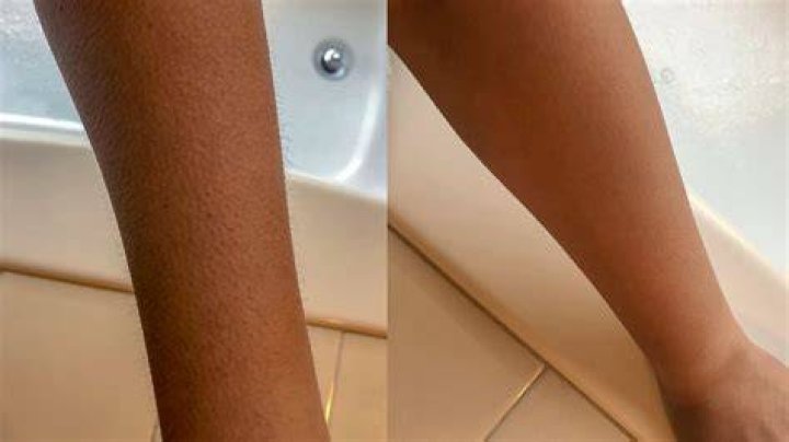 Is shaving your arms bad?