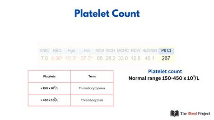 What is a normal plate class?